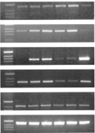 Fig. 4. mRNA levels of osteogenic markers as detected by reverse transcription-polymerase chain reaction