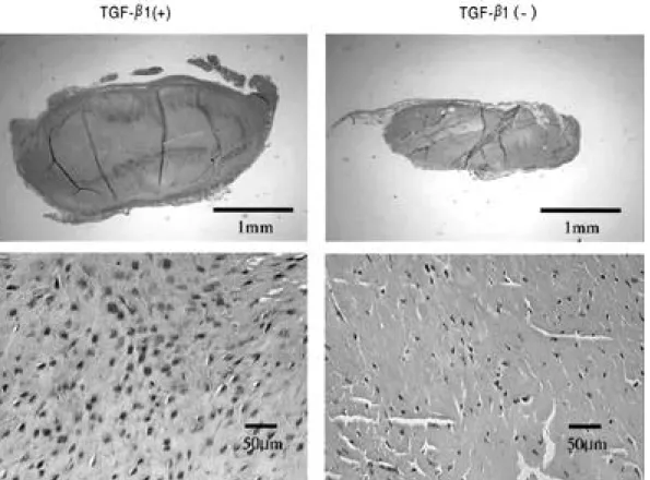 Fig. 1-A. Under the light microscopy after H-E staining, hypertrophy of right patellar tendon was observed at 1 week after the triple injection of TGF-β 1 ( ×20 magnification)