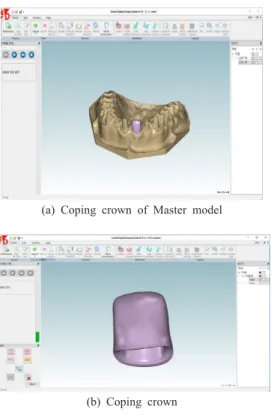 Table 1.  Material used Fig. 2.  Design of coping crown