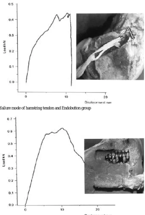Fig. 6. The result and failure mode of hamstring tendon and Endobutton group