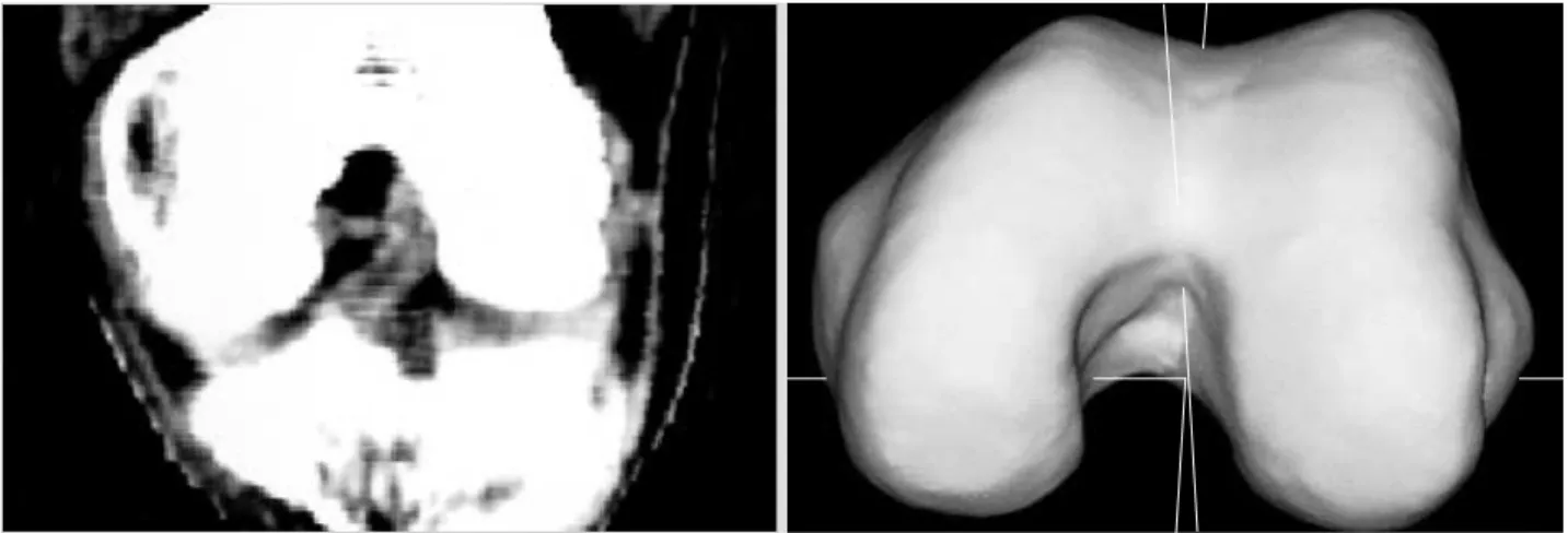Fig. 2. The isometric points placed on the three-dimensional model using line indicators are automatically displayed on the multiplanar reformatting images, and vice versa.