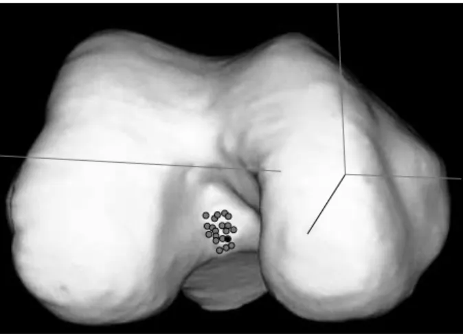 Fig. 5. A rapid prototyping mo- mo-del of a knee is shown.
