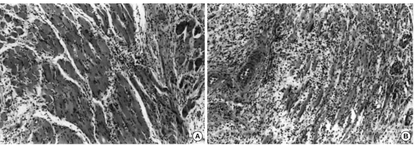 Fig. 7. Histologic grading of muscle in allotransplanted limb. A: Grade I rejection of muscle shows patchy infiltration of mononuclear cells (arrow) between myocytes at day 35 posttransplantation in group III (H&amp;E stain; ×100)