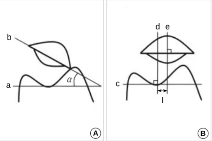 Fig. 1. A: Patellar tilt angles ( ) were measured as the angle between lines parellel to the ground passing the lowest point of the trochlear groove of the femur (a) and passing through the longest axis of the cut patella surface