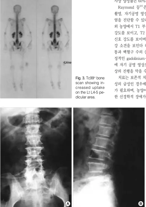 Fig. 4. Postoperative lumbar AP &amp; lateral X-ray showing L4 total laminectomy 