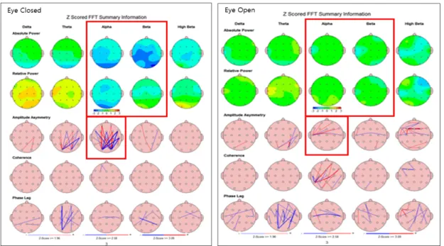 Fig. 2.  the result of Alpha wave revers and asymmetry in FFT Summary Information (Z scored Peak Frequency)야기하게  하는  것으로  보인다