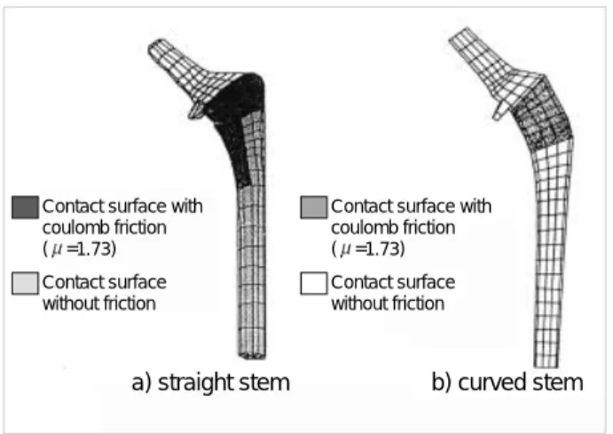 Fig. 2. Boundary conditions of single leg stance and stair climb- climb-ing were applied with peripheral direction and loads on the  3-dimensional total hip replacement system models.