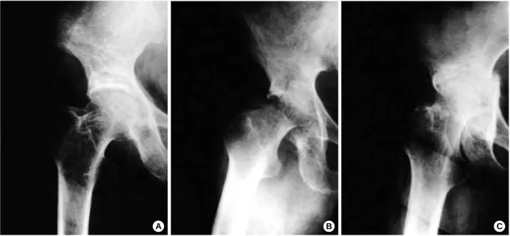Fig. 1. Light microscopic findings of the acetabulum at 4 years after irradiation (H&amp;E stain: ×40)