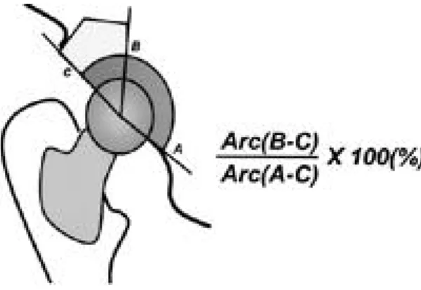 Fig. 1. Cup-graft contact area.