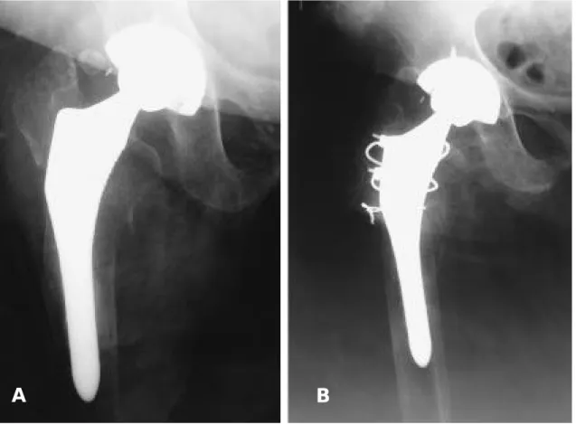 Fig. 2. B : This radiographs is postoperative X-ray.