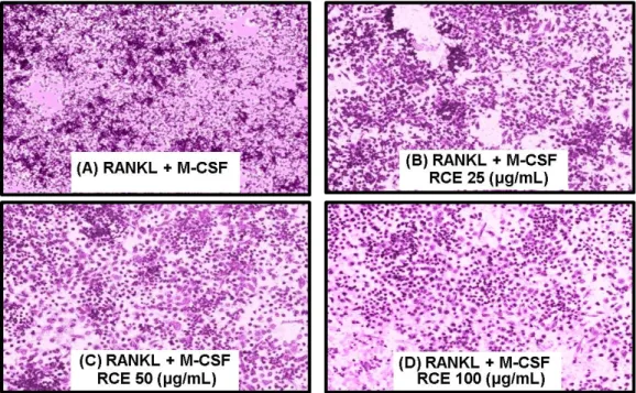 Fig. 5. Effect of RCE on M-CSF/RANKL-induced differentiation of pre-osteoclast RAW 264.7 cells