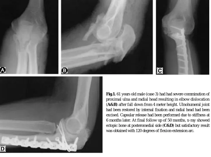 Table 1. Preoperative Findings