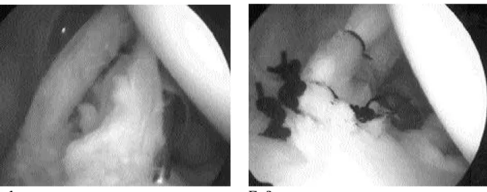 Fig. 1. Fig. 2. 