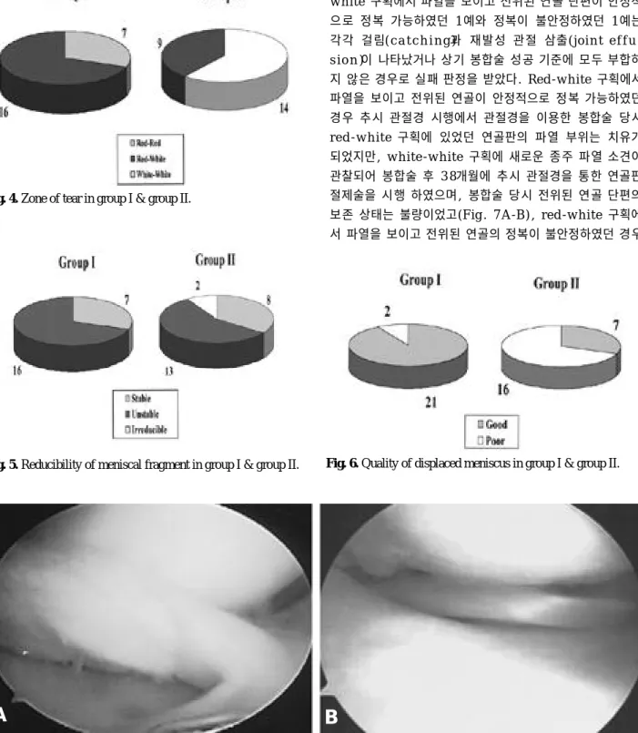 Fig. 5. Reducibility of meniscal fragment in group I &amp; group II. Fig. 6. Quality of displaced meniscus in group I &amp; group II.