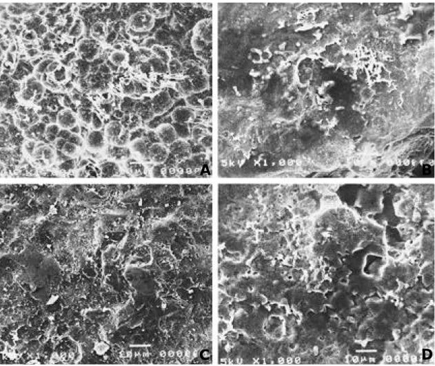 Fig. 1. Findings of scanning electron microscope of NiTi alloy surface (  × 1000 ) A: Porous coated surface before experiment 