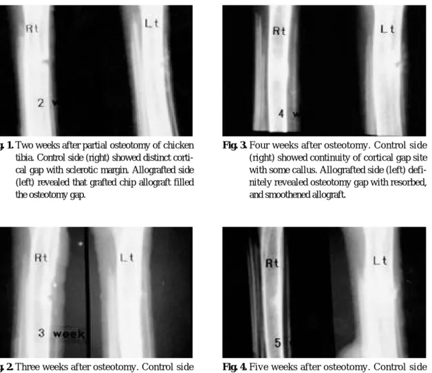 Fig. 4. Five weeks after osteotomy. Control side (right) showed complete remodelling of osteotomy site with some internal callus.