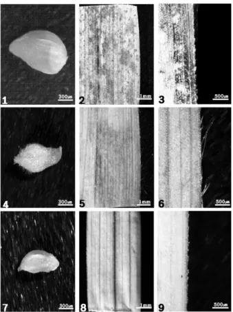 Fig. 4. The surface of the leaves and perigynium of the  sect.  Siderostictae taxa.