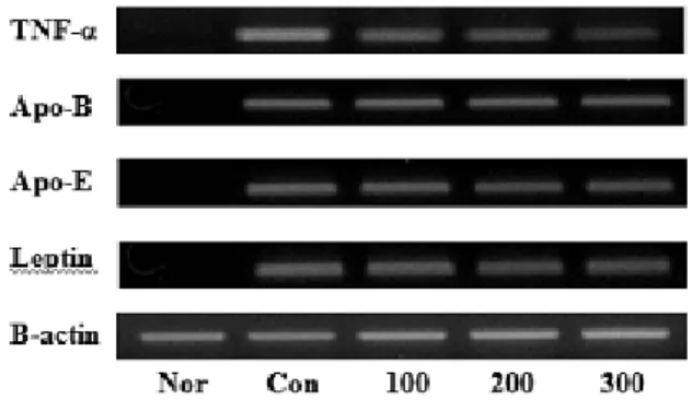 Fig. 1. RT-PCR analysis for TNF-α, Apo-B, Apo-E and  Leptin gene expression. Nor: Normal group, Con: Control  group, 100: 100 mg/kg Ixeris dentata ext., 200: 200 mg/kg  Ixeris dentata  ext., 300: 300 mg/kg  Ixeris dentata  ext.