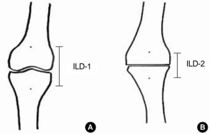 Fig. 2. A: Linker (anterior aspect). A variety of extension gaps can be adjusted by choosing the proper pair of holes