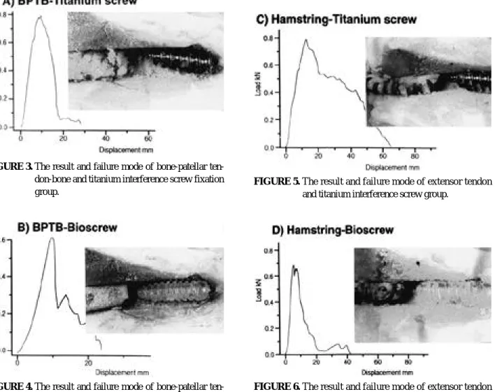 FIGURE 3. The result and failure mode of bone-patellar ten- ten-don-bone and titanium interference screw fixation group.