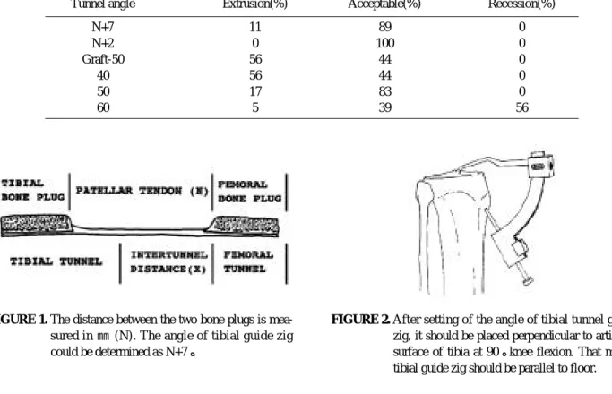 FIGURE 1. The distance between the two bone plugs is mea- mea-sured in  ㎜ (N). The angle of tibial guide zig could be determined as N+7°.
