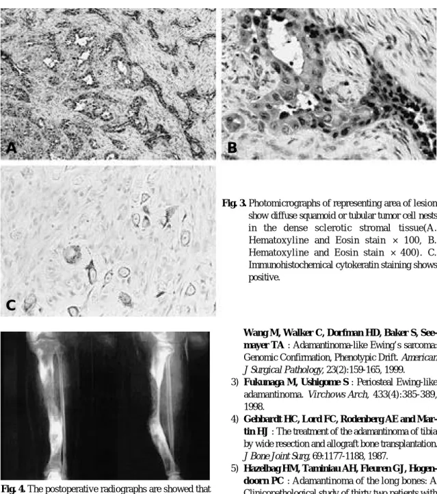 Fig. 4. The postoperative radiographs are showed that wide resection with bone graft was performed.