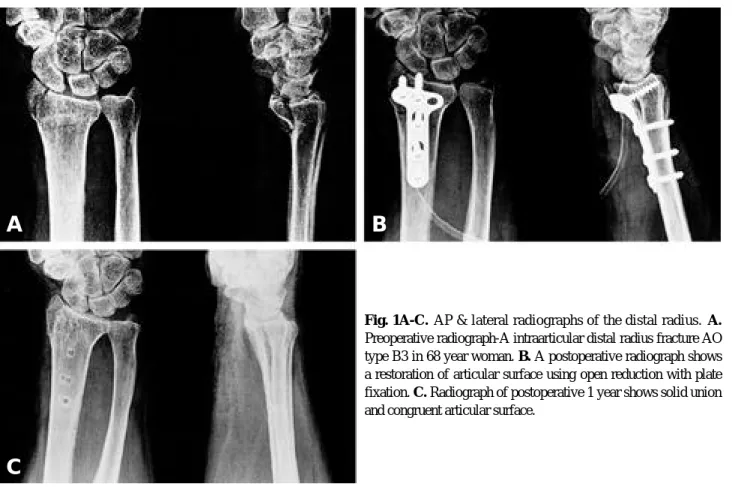 Table 4. Radiographic data of postoperation and recent follow-up