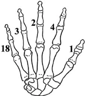 Fig. 1 Central tendon was mobilized by rubber band and fracture site was fixed with two 23 gauge needles.
