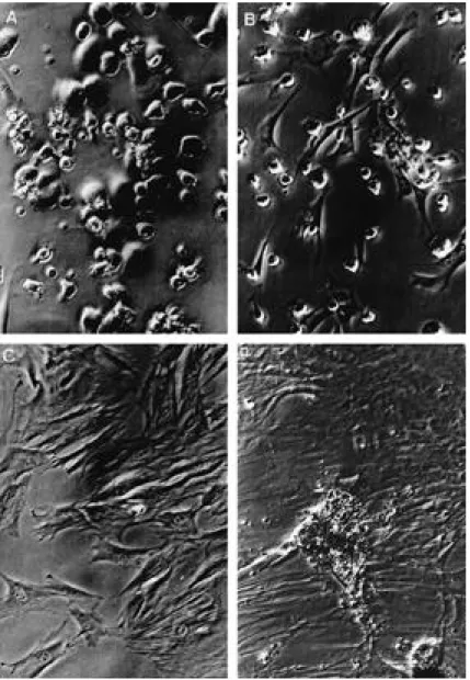 Fig. 1. Morphologic Change of MSCs by the cell culture periods(×300). Round cells at 1 week( A) were changed into polygonal shape as the t i m e ( 2 w e e k s (B), 4weeks(C), and 12weeks(D)) and made mineralized  nod-ules