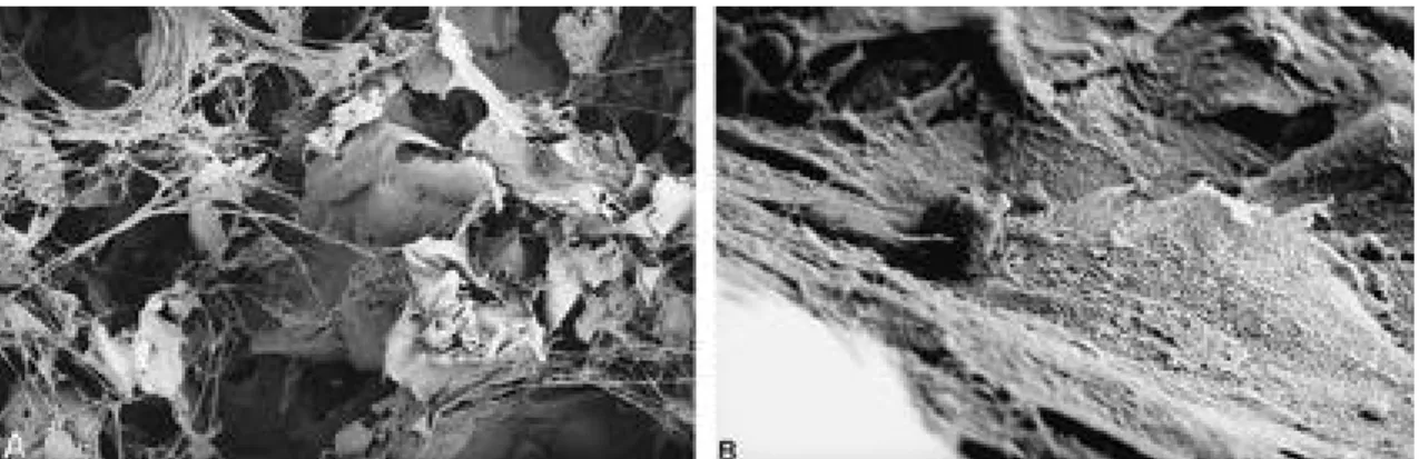 Fig. 7. SEM image of cell-scaffold composite. 7days later, the PLGA scaffold was covered with confluent MSCs(A.