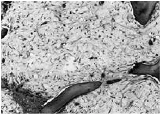 Fig. 3. The dead trabeculae with appositional bone was seen, which was obtained four weeks after LPS and heparin injection(H&amp;E; original  magnifica-tion, ×100).