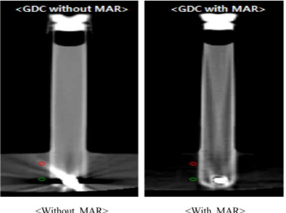 Fig. 8. CT value measurement of GDC Coil CT Image  of MAR Algorithm application for before and  after