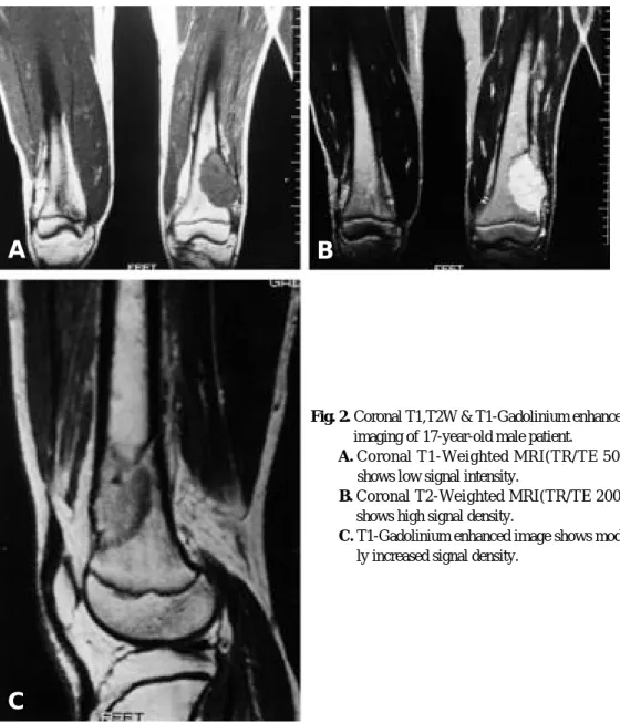 Fig. A. Coronal T1-Weighted MRI(TR/TE 500/12) shows low signal intensity.