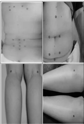 Fig. 2. Simulation acupuncture  points