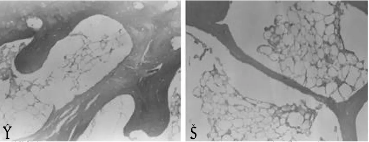 Fig. 1-A, B. Histologic findings of the subchondral bone and bone marrow of Group 1 at 16 weeks