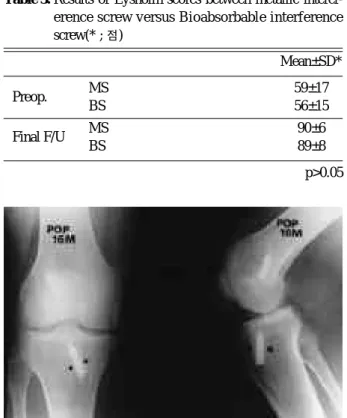 Table 2. Results of Cybex test ; average muscle power of injured quadriceps muscles compared with normal leg(* ; %)