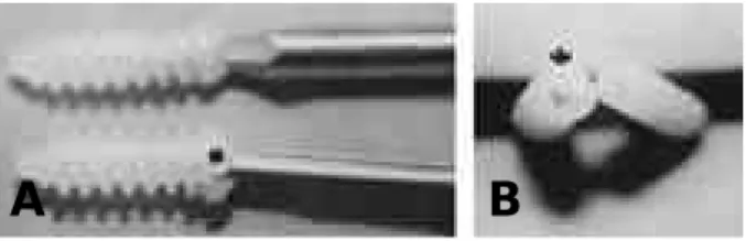 FIGURE 2. Broken screw head in the bioabsorbable interfer- interfer-ence screw during femoral tunel fixation