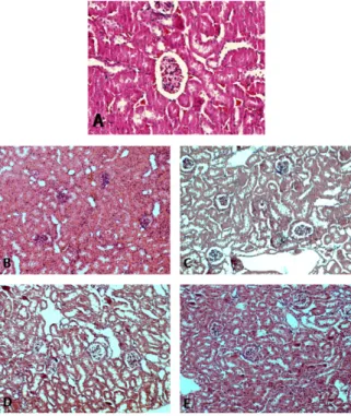 Fig. 5.  Histopathological changes of renal cell in mice treated lead acetate and/or Lespedeza Caneata extract(H&amp;E stain) A: Pb no  treatment(×200), B: Pb treatment for 4 week(×100), C: Pb and Lespedeza Caneata extract treatment for 4 week(×100), D: 