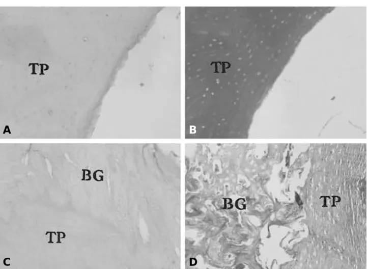 Fig. 4-C, D. Reveal the complete union showing trabecular bone between transverse process(3C:H-E stain  × 200, 3B:Trichrome stain  × 200).