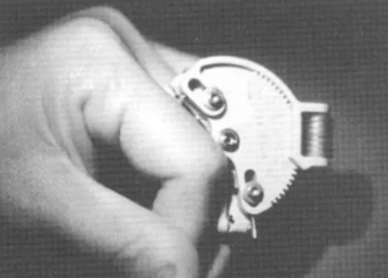 Fig . 6 . Five degree extension lag on middle finger proximal inter - phalangeal joint after one year of this procedure.