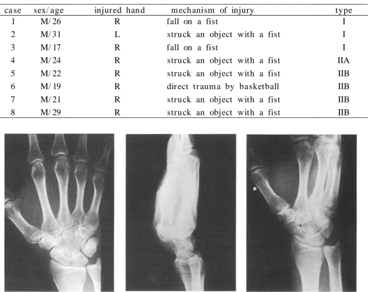 Fig . 2. Anatomic reduction was achieved by open reduction and internal fixation with K-wires.