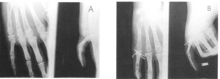 Fig . 2 . 14 year old boy