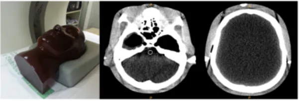 Fig.  3. Image of reformation according to slice  thickness variance  