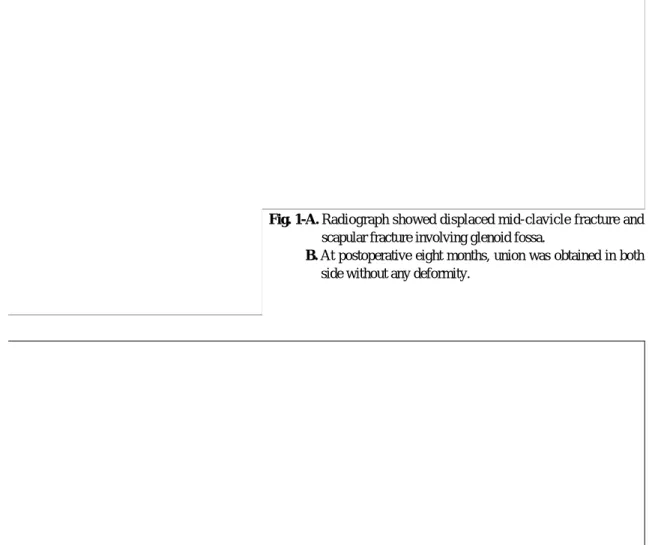 Fig. 1-B. At postoperative eight months, union was obtained in both side without any deformity.