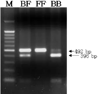 Fig. 1. PCR-RFLP patterns for apoVLDL-Ⅱ gene with Sfc I res- res-triction enzyme digestion