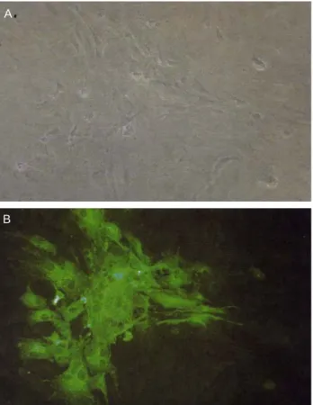 Fig. 7. Cytopathic effect of vaccine MDV, CVI988/Rispens strain,  on CEF cells. A, Phase contrast image of infected cells; 