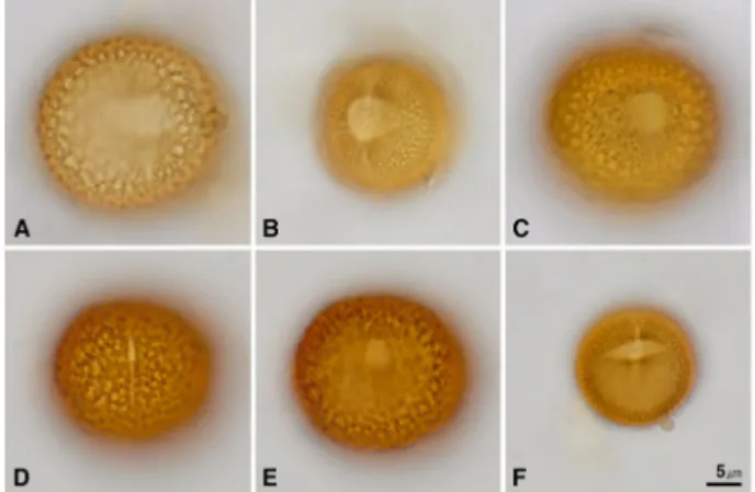 Fig. 1. LM micrographs of pollen apertures in  Oldenlandia . A.  O.