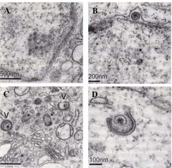 Fig. 4. Electron micrographs showing different stages in the en- en-velopment of MDV virions in a chicken embryo fibroblast  cell that had been infected with MDV using BAC20