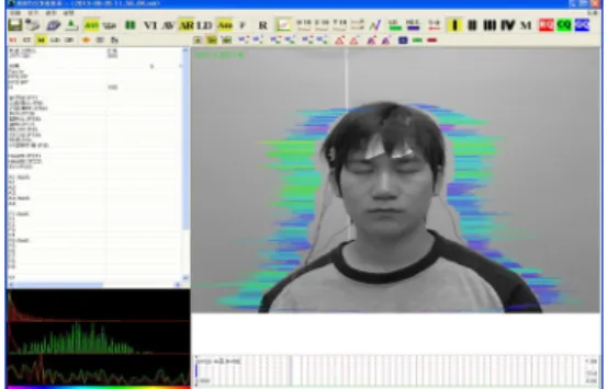 Fig.  4.  EEG relative    and vibraimage Neuroticism  Raw data comparative analysis