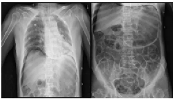 Fig. 2. Conducted at Local Hospital Electrocardiogram.